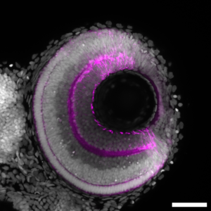Developing zebrafish retina at 72 hours post fertilization with retinal ganglion cells and photoreceptors in magenta and nuclei in grey. Scale bar: 50µm. (Image: N. Gampl)