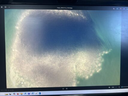 Microscopic image of the bisected organoid sample acquired with the inverted microscope during alignment of the indenter tip above the sample. The shadow of the indenter tip is visible above the organoid. Photo: O. Neumann