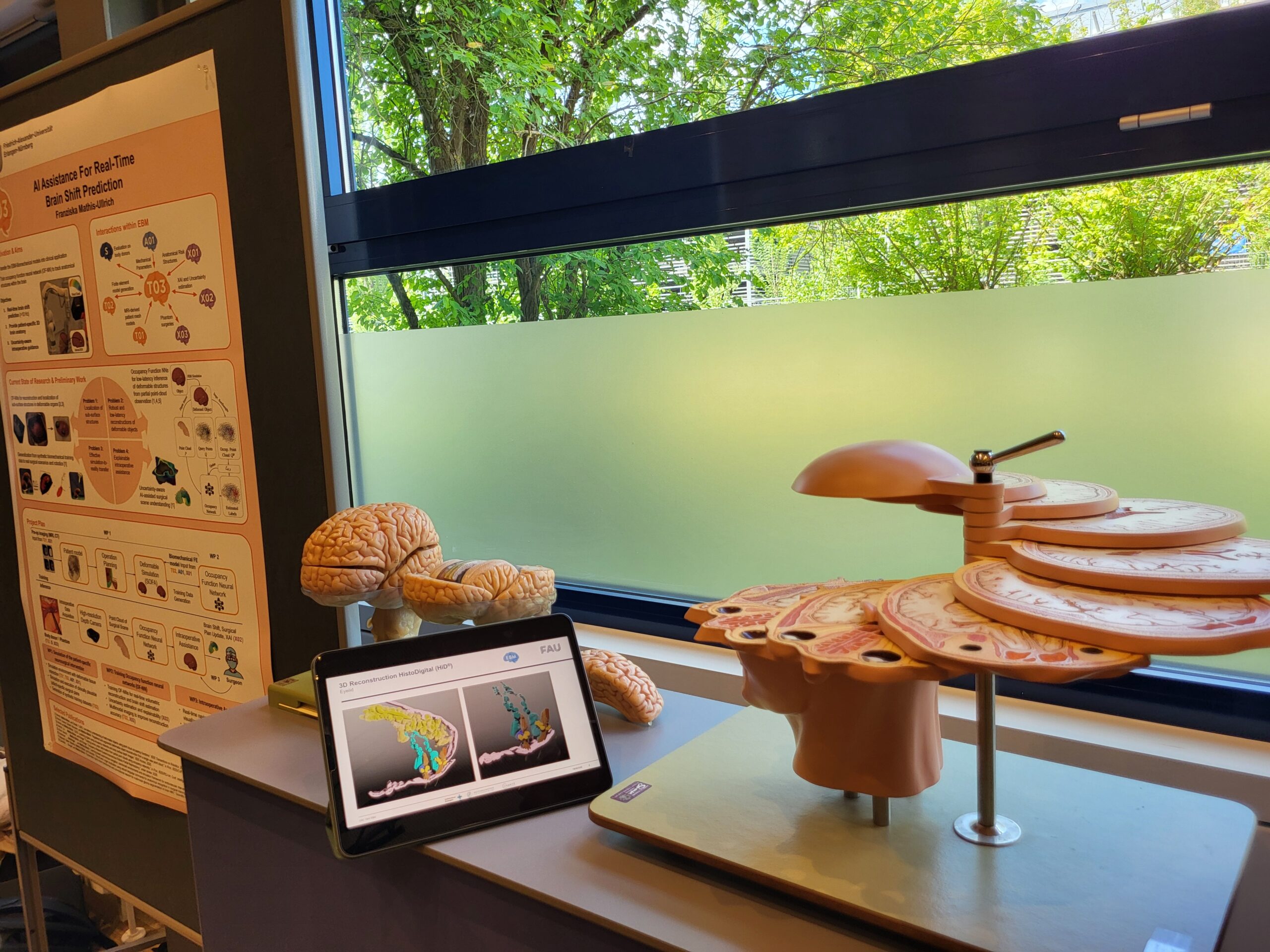 Anatomical brain models on display. Photo: A. Dakkouri-Baldauf